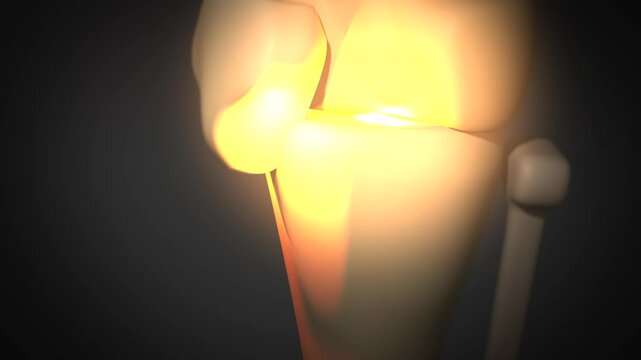 A Knee Animation with Bone on Bone Arthritis

No AI was used in the making of this clip. Clip rendered in Blender and After Effects.