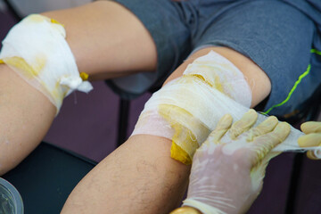 Knee pain in an elderly person use thai herbal compress ball or herbal on knee. Knee pain may cause from muscle strain, tendinosis, Knee osteoarthritis. Thai traditional medicin