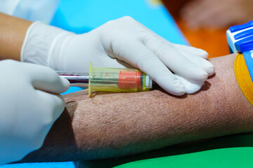 Close up hand collecting blood sample for diagnosis and treatment patient in the hospital.Laboratory technician taking blood for blood chemistry analysis