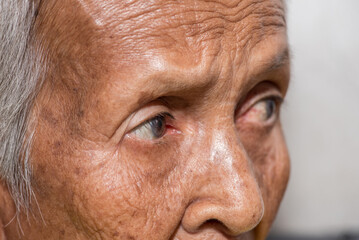 The old woman's felling lonely.(dementia and Alzheimer’s disease)
