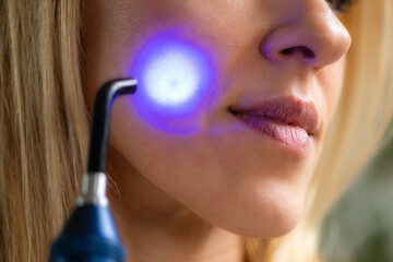 Blue light therapy targets facial acne, reducing bacteria and inflammation. Promoting clearer skin...