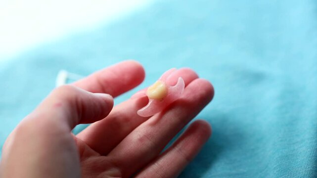  Removable denture type Butterfly on a hand. Replacement of one missing tooth. immediate denture. Flipper denture, Single artificial denture - false tooth - elastic prosthesis