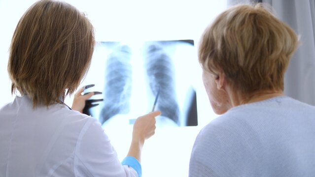 Doctor pointing at a chest x ray, explaining results to a senior patient in a hospital setting, highlighting key aspects of the radiography for better understanding of her health condition