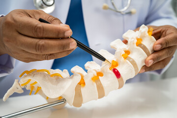 Doctor with lumbar vertebra bone skeleton and nerve model for treatment in the orthopedic...