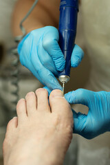 Gloved technician works on toenails using rotary file for shaping. Chiropody and podology concept, foot care
