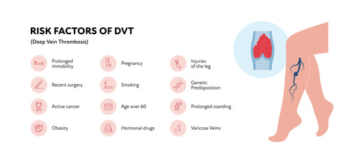 Deep vein thrombosis for healthcare infographic. Vector outline icon set illustration. Risk factor of DVT. Woman leg with thromb in blood vessel symbol. Design for health care, education