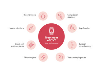 Deep vein thrombosis for healthcare infographic. Vector outline icon set illustration. Treatment of DVT. Blood vessel with thromb symbol. Design for health care, education