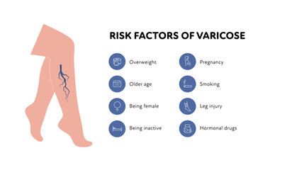 Varicose vascular disease for healthcare infographic. Vector outline icon set illustration. Risk factor of DVT. Woman leg with thromb in blood vessel symbol. Design for health care, education
