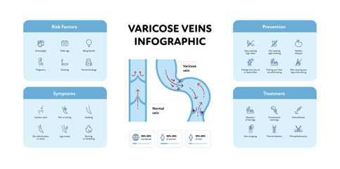 Varicose vascular disease for healthcare infographic. Vector outline icon set illustration. Risk factor, prevention, symptoms, treatment of DVT. Gender probability and blood vessel chart.