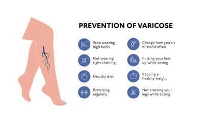 Varicose vascular disease for healthcare infographic. Vector outline icon set illustration. Prevention of DVT. Woman leg with thromb in blood vessel symbol. Design for health care, education