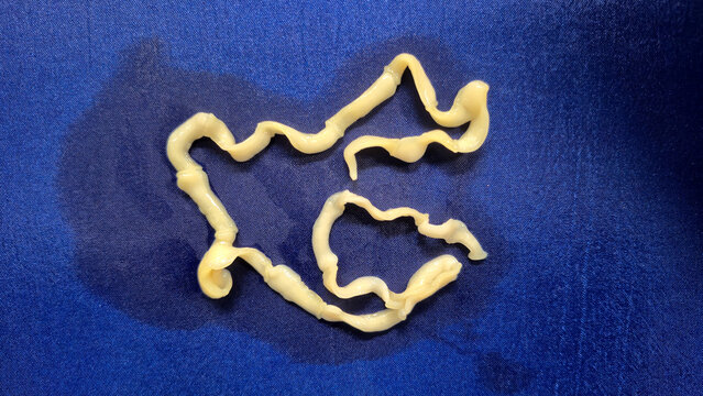 Tapeworm infection is caused by ingesting food or water contaminated with tapeworm eggs or larvae in laboratory.