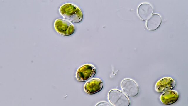 Green algae under microscope, Cosmarium algae 