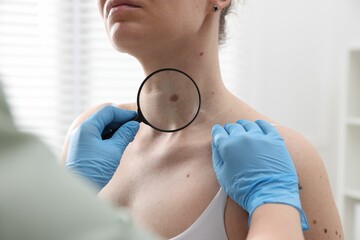 Doctor examining woman's moles in hospital, closeup