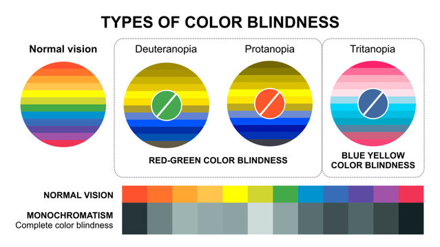 Types of Color Blindness Test Illustration