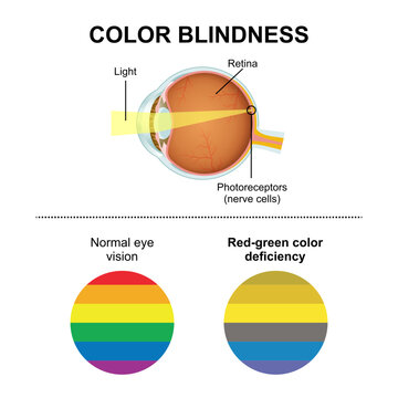 Color Blindness Eye Illustration its type
