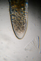 demodex face mite body parts under the microscop