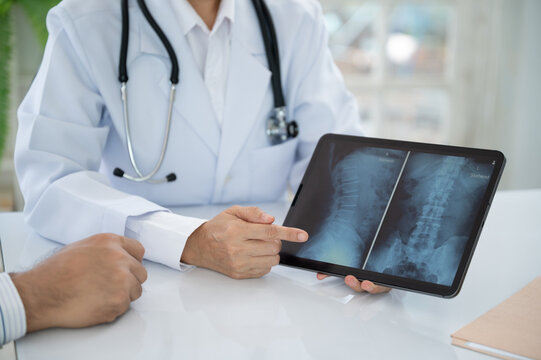 doctor or adiologic technologist diagnose x-ray image of spine lumber vertebrae that shows herniated disc disease of patient.