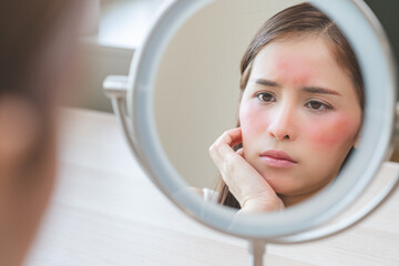 Dermatology, scratch asian young woman looking at mirror, expression worry and itch, itchy allergy...