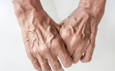 Fototapeta premium Hand and finger man is rough skin and wrinkles. Gesture on a whi