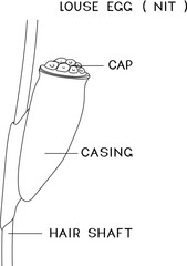 Coloring page with structure of head louse egg (nit) attached to a hair for biology lesson