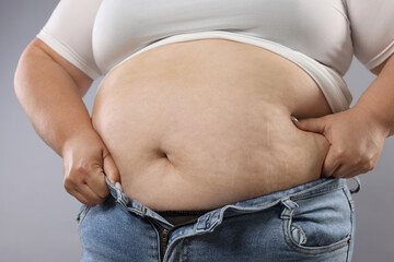 Naklejka premium Woman with excessive belly fat on grey background, closeup. Overweight problem