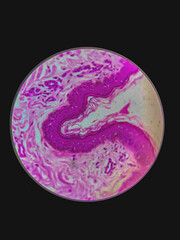 Micrograph of peripheral nervous tissue stained with hematoxylin and eosin.