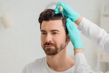 Doctor applying serum for hair growth on man's scalp in clinic