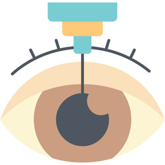 Cataract Surgery Illustration