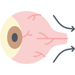 Ocular Oncology Illustration