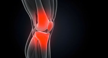 Knee Joint Pain Illustration