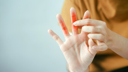 Hand pain finger injury red skin closeup health discomfort person touching medical problem human adult inflammation joint illness disease symptom care therapy treatment stress ache arthritis.