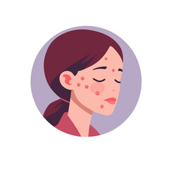 illustration of a girl's face full of acne 