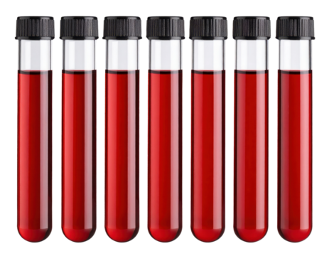 Seven test tubes filled with red liquid, sealed with black caps, standing upright in a row.