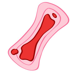 serviette hygiénique rose avec sang flux important