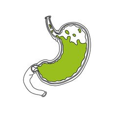 Vector illustration line drawing, stomach disease Gastroesophageal Reflux Disease. Comparison of normal stomach with GERD stomach. Illustration for medical, poster symbol, logo, or study science