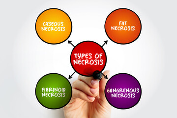 Types of Necrosis (death of body tissue) mind map text concept for presentations and reports