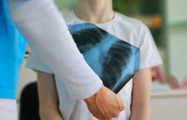 Medical professional examines chest X-ray of a patient in a healthcare