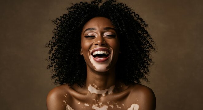 Joyful Black woman with vitiligo laughing with eyes closed against a brown background. Celebrating unique beauty, diversity, and happiness.