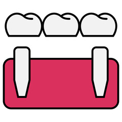 Dental Bridge