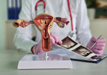 Gynecologist examines results of examination of uterus. Ultrasound diagnostics of pelvic organs...