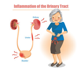 Urinary Tract Inflammation and Infection
