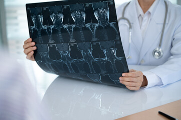 Orthopedist checkup cervical spine x-ray film and diagnose cervical spondylosis at doctor room.