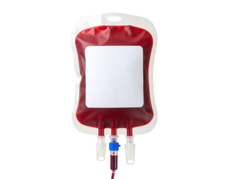 A red blood bag with tubing and connectors designed for blood transfusion or storage.