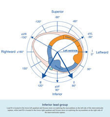 In frontal lead system, leads Ⅱ, Ⅲ and aVF belong to anatomically contiguous lead and are combined into inferior lead group to explore diaphragmatic myocardium.
