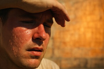 Understanding heat stress: protecting against overheating in intense sunlight