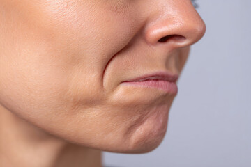 Obraz premium Close up of person face showing tense jaw, possibly indicating TMJ disorder. skin appears smooth and expression is focused. background is neutral, highlighting facial features