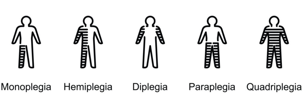 Paralysis Types banner web icon vector illustration of Monoplegia, Hemiplegia, Diplegia, Paraplegia, Quadriplegia