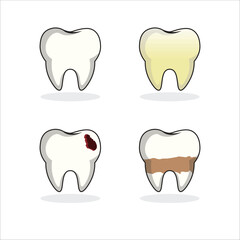 Dental vector showing healthy, stained, decayed, and plaque teeth