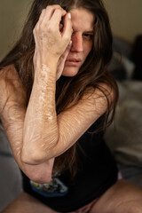 A woman sits in a moment of emotional vulnerability, revealing deep self-harm scars on her arm. Her...