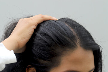 Naklejka premium Woman with hair loss dryness and frizziness